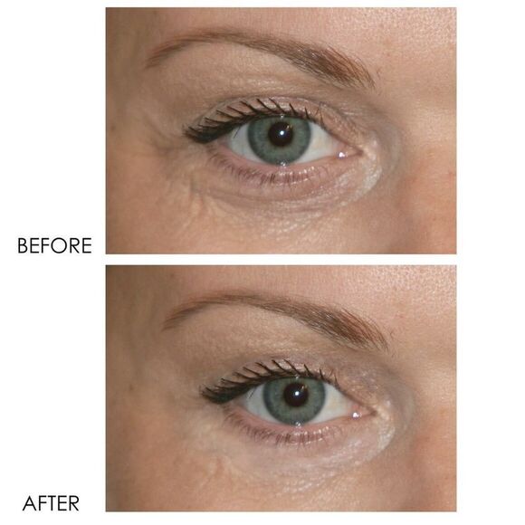 Dermelct Revitalite Eyelid & Dark Circle Corrector - Picture 4 of 4